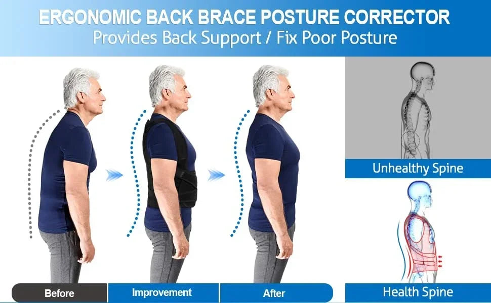 Posture Corrector & Back Brace – Scoliosis and Hunchback Correction for Men & Women